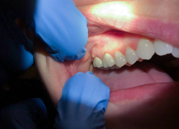 Best 24-Hour Emergency Dentist  in Breckenridge, MI